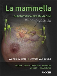 La mammella. Diagnostica per immagini - Librerie.coop