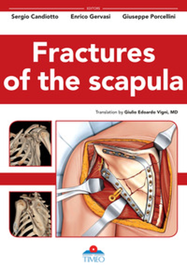Fractures of the scapula - Librerie.coop