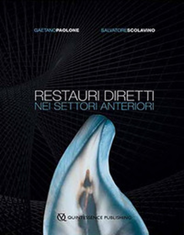 Restauri diretti nei settori anteriori - Librerie.coop Restauri diretti nei settori anteriori - Librerie.coop