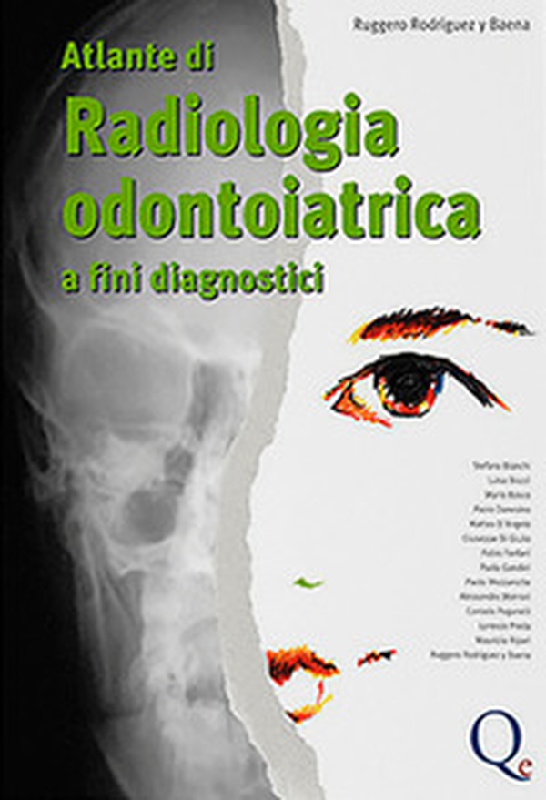 Atlante di radiologia odontoiatrica. A fini diagnostici - Librerie.coop Atlante di radiologia odontoiatrica. A fini diagnostici - Librerie.coop