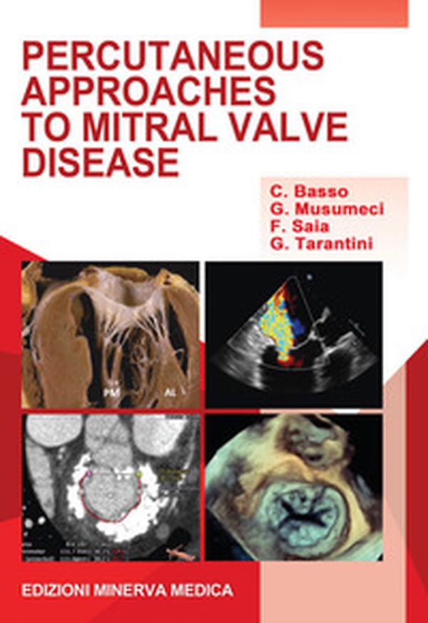 Percutaneous approaches to mitral valve disease - Librerie.coop Percutaneous approaches to mitral valve disease - Librerie.coop