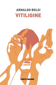 Vitiligine - Librerie.coop