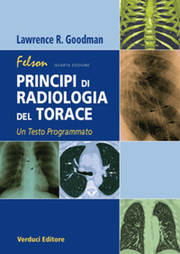 Felson. Principi di radiologia del torace. Un testo programmato - Librerie.coop