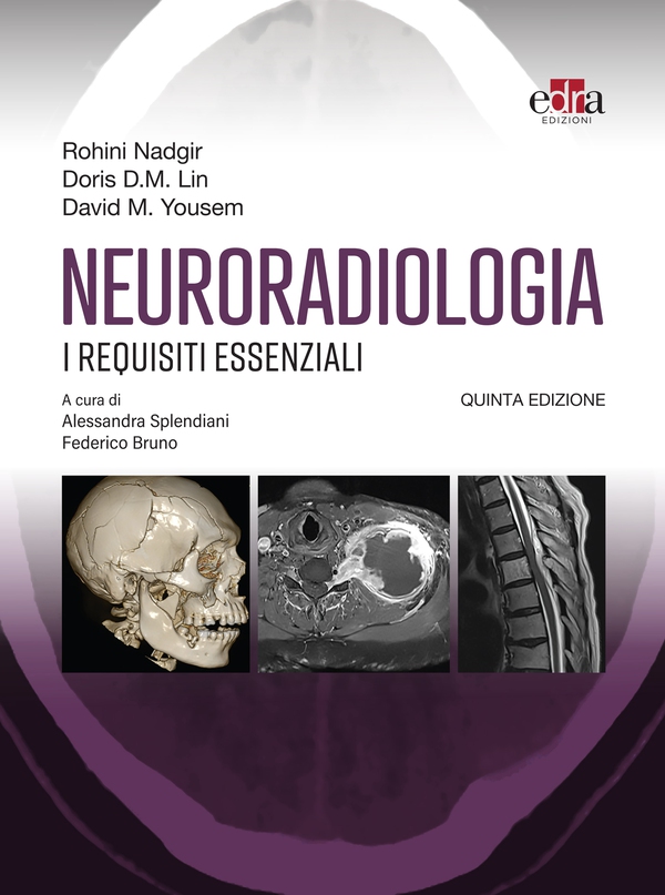 Neuroradiologia - Librerie.coop