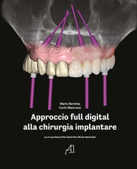 Approccio full digital alla chirurgia implantare - Librerie.coop