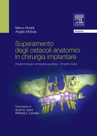 Superamento degli ostacoli anatomici in chiurgia implantare - Librerie.coop