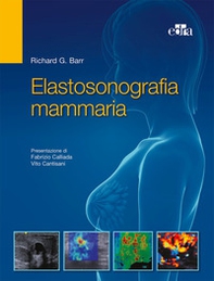 Elastosonografia mammaria - Librerie.coop