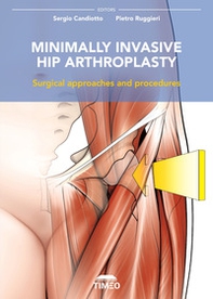 Minimally invasive hip arthroplasty. Surgical approaches and procedures - Librerie.coop