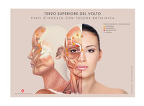 Terzo inferiore e terzo superiore del volto. Punti d'inoculo con tossina botulinica. Tavole - Librerie.coop