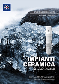 Impianti ceramica. La sfida vincente. Sistema implantare Zibone - Librerie.coop Impianti ceramica. La sfida vincente. Sistema implantare Zibone - Librerie.coop