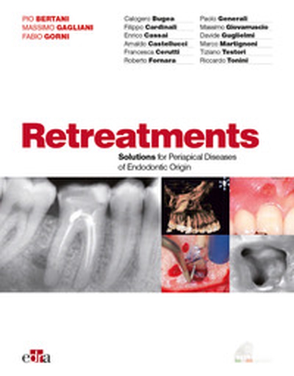 Ritrattamenti. Soluzioni per le patologie periapicali di origine endodontica - Librerie.coop Ritrattamenti. Soluzioni per le patologie periapicali di origine endodontica - Librerie.coop