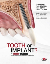 Tooth or Implant? The recovery or replacement of the severely compormised natural tooth - Librerie.coop