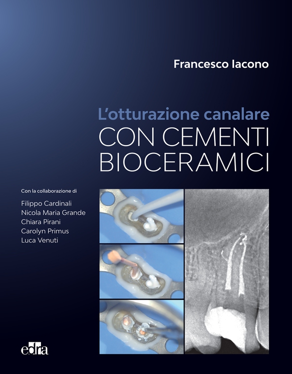 L'otturazione canalare con i cementi bioceramici - Librerie.coop L'otturazione canalare con i cementi bioceramici - Librerie.coop
