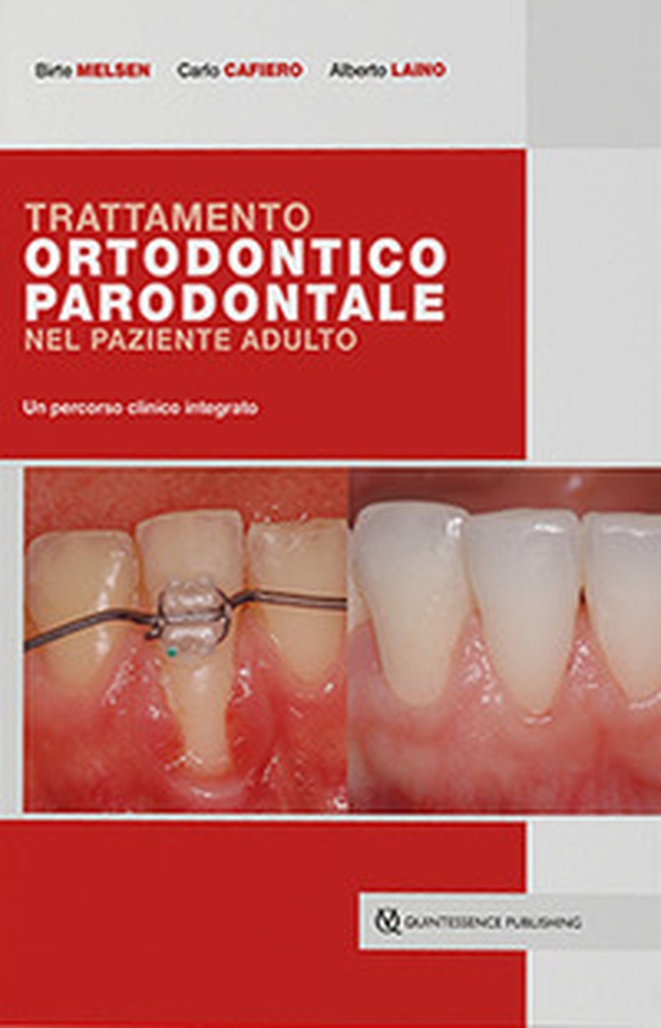 Trattamento ortodontico parodontale nel paziente adulto. Un percorso clinico integrato - Librerie.coop Trattamento ortodontico parodontale nel paziente adulto. Un percorso clinico integrato - Librerie.coop
