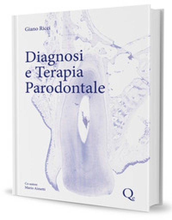 Diagnosi e terapia parodontale. Un compendio di conoscenza scientifica e di 40 anni di esperienza clinica - Librerie.coop Diagnosi e terapia parodontale. Un compendio di conoscenza scientifica e di 40 anni di esperienza clinica - Librerie.coop
