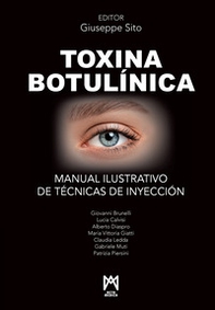 Toxina Botulínica. Manual ilustrativo de técnicas de inyección - Librerie.coop