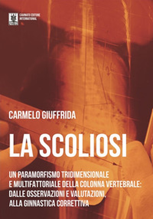 La scoliosi. Un paramorfismo tridimensionale e multifattoriale della colonna vertebrale: dalle osservazioni e valutazioni alla ginnastica correttiva - Librerie.coop La scoliosi. Un paramorfismo tridimensionale e multifattoriale della colonna vertebrale: dalle osservazioni e valutazioni alla ginnastica correttiva - Librerie.coop