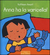 Anna ha la varicella! - Librerie.coop
