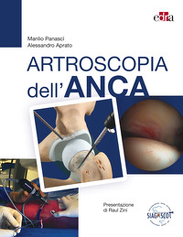 Artroscopia dell'anca - Librerie.coop