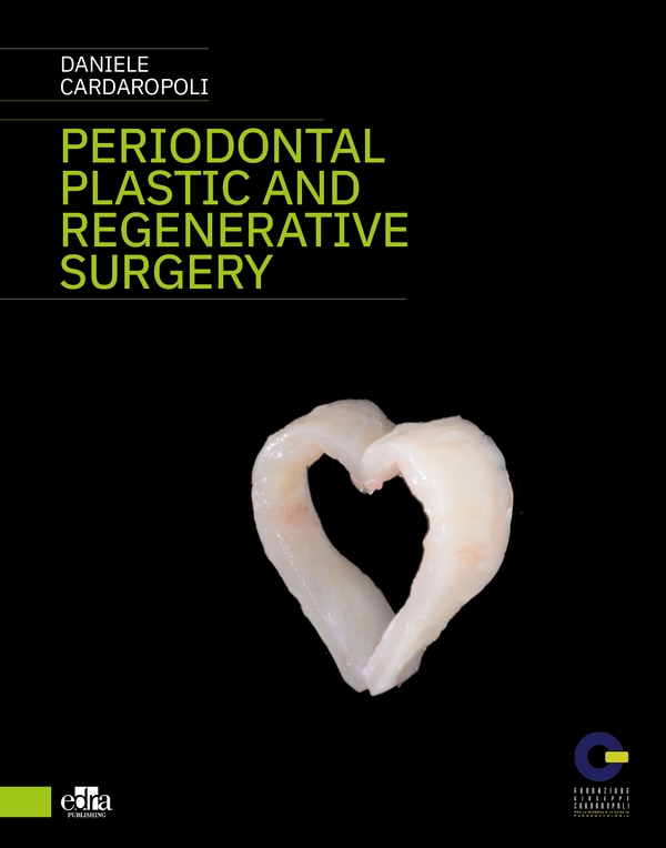 Periodontal plastic and regenerative surgery - Librerie.coop Periodontal plastic and regenerative surgery - Librerie.coop