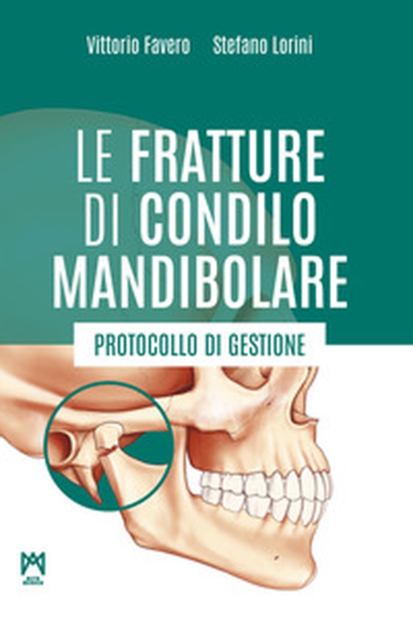Le fratture di condilo mandibolare. Protocollo di gestione - Librerie.coop