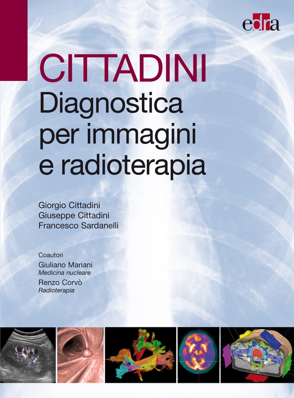 CITTADINI Diagnostica per immagini e radioterapia - Librerie.coop CITTADINI Diagnostica per immagini e radioterapia - Librerie.coop