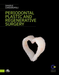Periodontal plastic and regenerative surgery - Librerie.coop Periodontal plastic and regenerative surgery - Librerie.coop