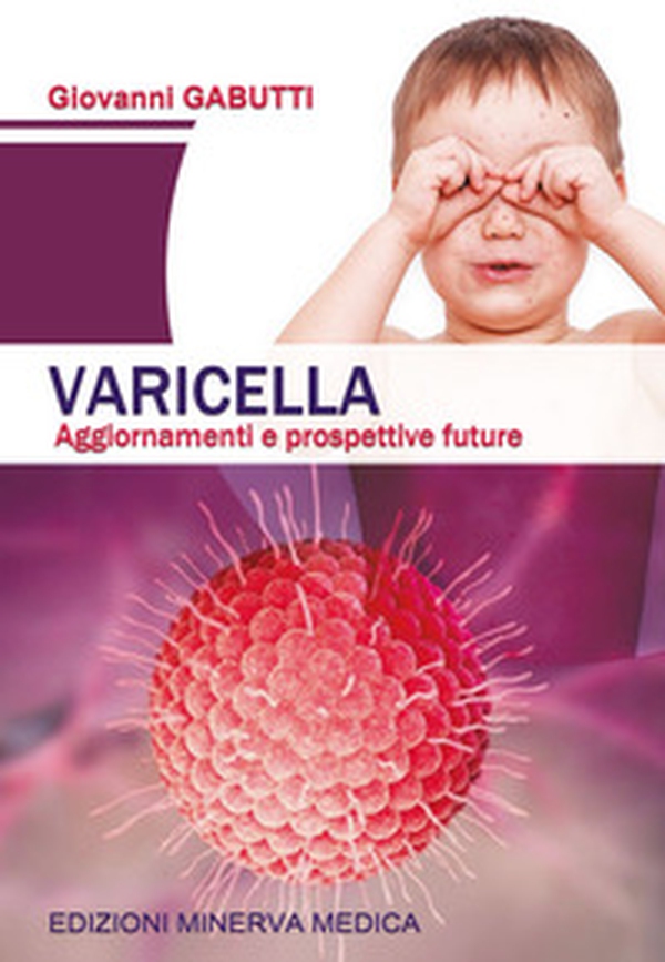 Varicella. Aggiornamenti e prospettive future - Librerie.coop Varicella. Aggiornamenti e prospettive future - Librerie.coop