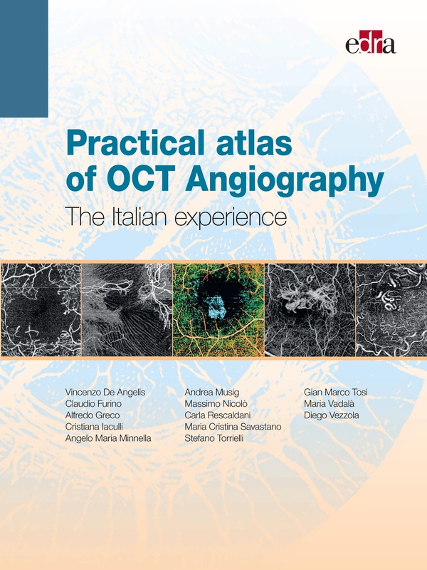 Practical atlas of OCT Angiography - Librerie.coop Practical atlas of OCT Angiography - Librerie.coop