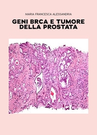 Geni BRCA e tumore della prostata - Librerie.coop