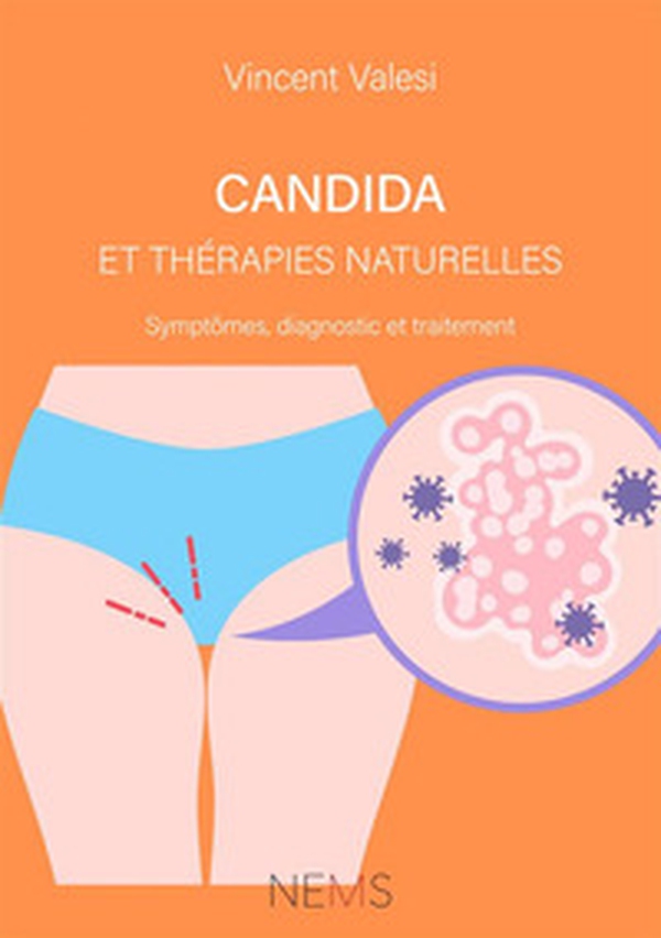 Candida et Thérapies naturelles. Symptômes, diagnostic et traitement - Librerie.coop Candida et Thérapies naturelles. Symptômes, diagnostic et traitement - Librerie.coop