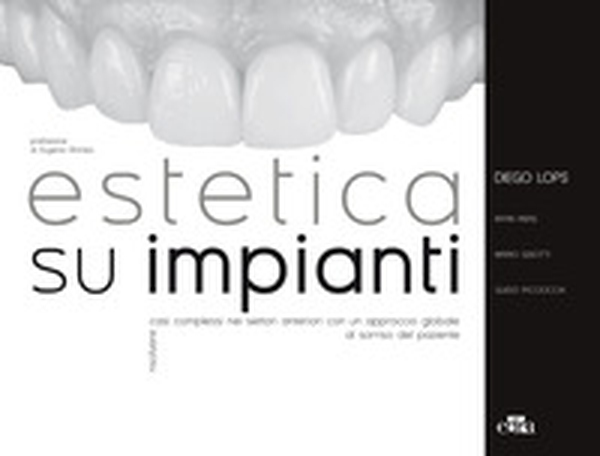 Estetica su impianti. Risolvere casi complessi nei settori anteriori con un approccio globale al sorriso del paziente - Librerie.coop Estetica su impianti. Risolvere casi complessi nei settori anteriori con un approccio globale al sorriso del paziente - Librerie.coop
