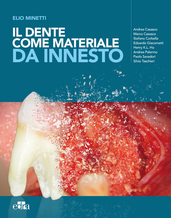Il dente come materiale da innesto - Librerie.coop Il dente come materiale da innesto - Librerie.coop