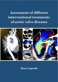 Assessment of different interventional treatments of aortic valve diseases - Librerie.coop