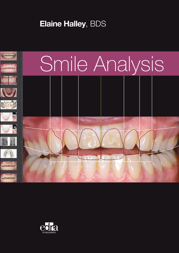 Smile Analysis - Librerie.coop Smile Analysis - Librerie.coop
