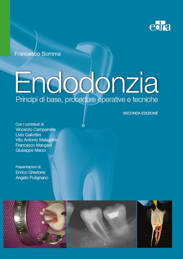 Endodonzia - Librerie.coop Endodonzia - Librerie.coop