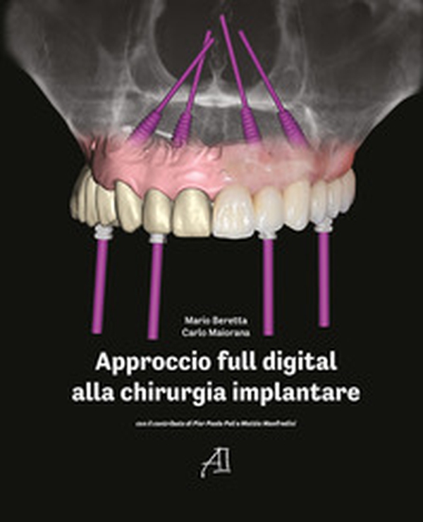 Approccio full digital alla chirurgia implantare - Librerie.coop Approccio full digital alla chirurgia implantare - Librerie.coop