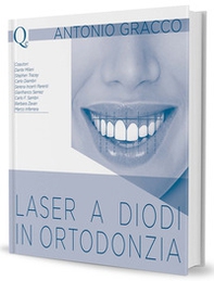 Laser a diodi in ortodonzia - Librerie.coop Laser a diodi in ortodonzia - Librerie.coop