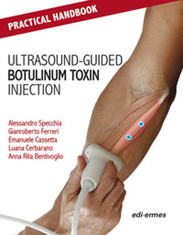 Practical handbook for ultrasound-guided botulinum toxin injection - Librerie.coop Practical handbook for ultrasound-guided botulinum toxin injection - Librerie.coop