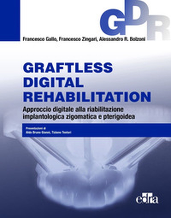 Graftless digital rehabilitatio, GDR. Approccio digitale alla riabilitazione implantologica zigomatica e pterigoidea - Librerie.coop Graftless digital rehabilitatio, GDR. Approccio digitale alla riabilitazione implantologica zigomatica e pterigoidea - Librerie.coop