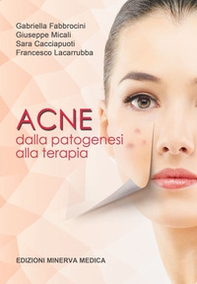 Acne. Dalla patogenesi alla terapia - Librerie.coop