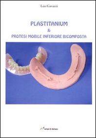 Plastitanium & protesi mobile inferiore bicomposta - Librerie.coop