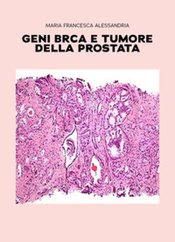 Geni BRCA e tumore della prostata - Librerie.coop Geni BRCA e tumore della prostata - Librerie.coop
