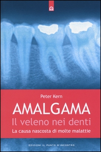 Amalgama. Il veleno nei denti. La causa nascosta di molte malattie - Librerie.coop