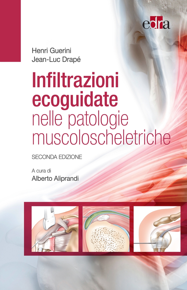 Infiltrazioni ecoguidate nelle patologie muscoloscheletriche - Librerie.coop Infiltrazioni ecoguidate nelle patologie muscoloscheletriche - Librerie.coop