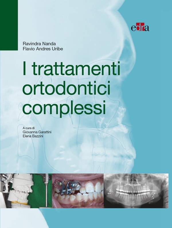I trattamenti ortodontici complessi - Librerie.coop I trattamenti ortodontici complessi - Librerie.coop