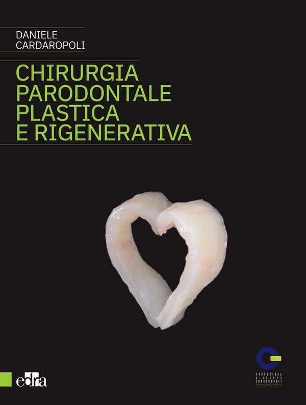 Chirurgia parodontale plastica e rigenerativa - Librerie.coop Chirurgia parodontale plastica e rigenerativa - Librerie.coop