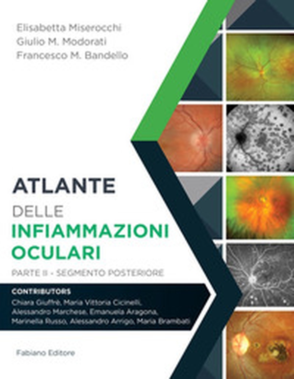 Atlante delle infiammazioni oculari - Librerie.coop
