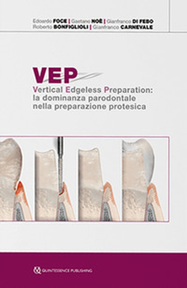 VEP. Vertical edgeless preparation: la dominanza parodontale nella preparazione protesica - Librerie.coop VEP. Vertical edgeless preparation: la dominanza parodontale nella preparazione protesica - Librerie.coop