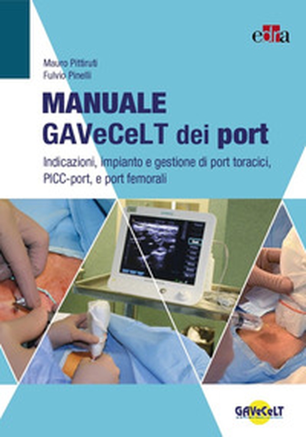 Manuale GAVeCeLT dei port. Indicazioni, impianto e gestione di port toracici, PICC-port e port femorali - Librerie.coop Manuale GAVeCeLT dei port. Indicazioni, impianto e gestione di port toracici, PICC-port e port femorali - Librerie.coop
